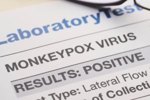 Monkeypox Results image